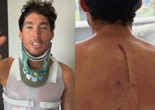 MotoGP 2026. Le prime parole di Aleix Espargaro dopo l'incidente: "Finalmente sono in piedi" [VIDEO]